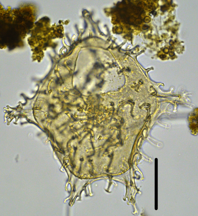 Wetzeliella articulata Wart27XCC070998b.jpg